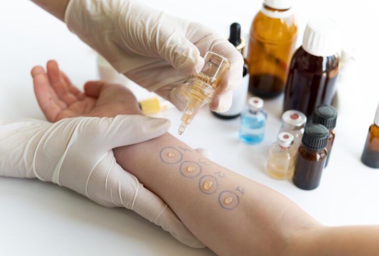 alergologia dzieci a doroslych roznice
